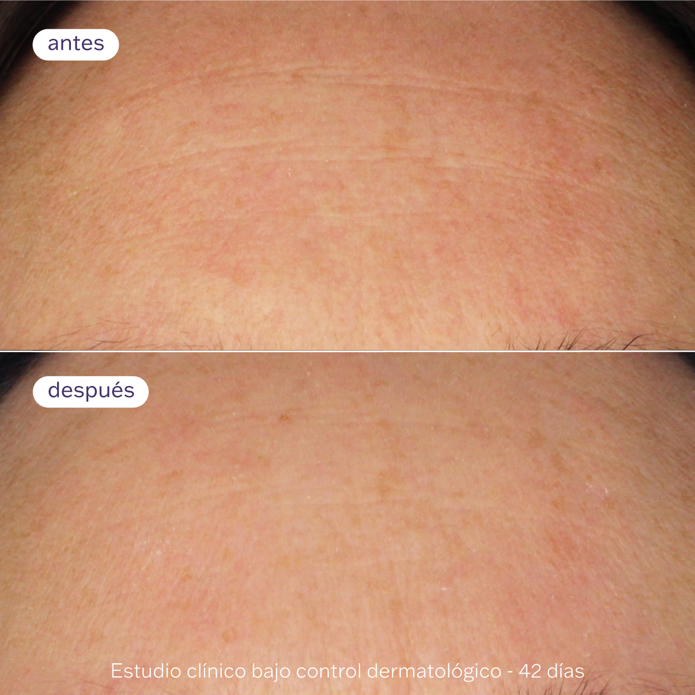 Doble Sérum Booster Pro-Retinol 30ml