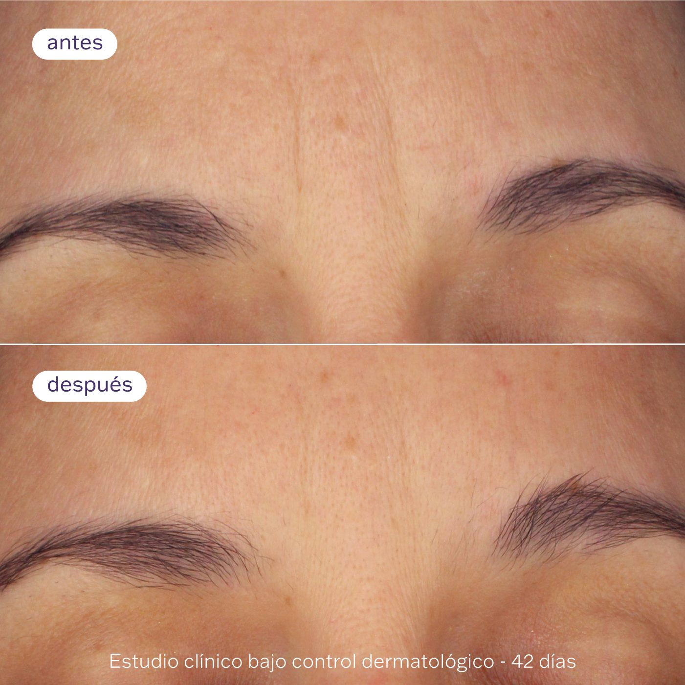 Doble Sérum Booster Pro-Retinol 30ml